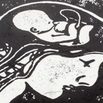 'Conception' - Expressionist Xylograph Print of X-Ray of Man and Fetus